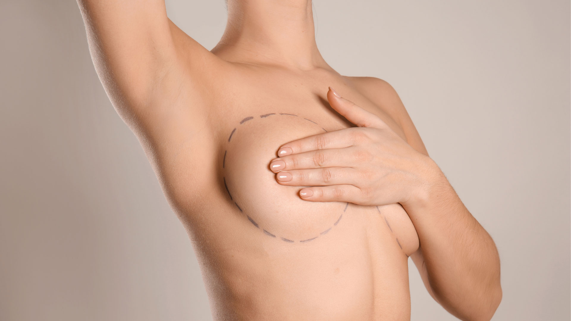 Breast Lift - Elite Plastic Surgery